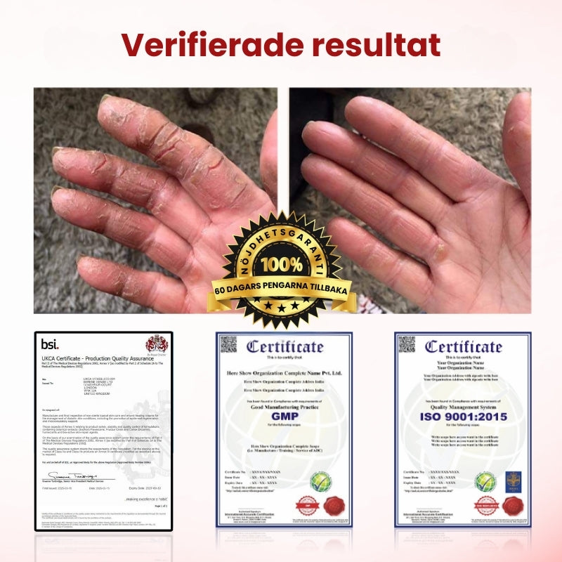 VitaGluco™ | Diabetisk Sårvårdskräm