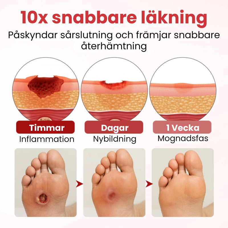 VitaGluco™ | Diabetisk Sårvårdskräm