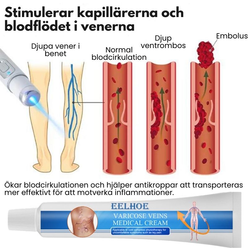 ÅderbråckKlar™ | Fullständig eliminering av åderbråck på bara 4 veckor!