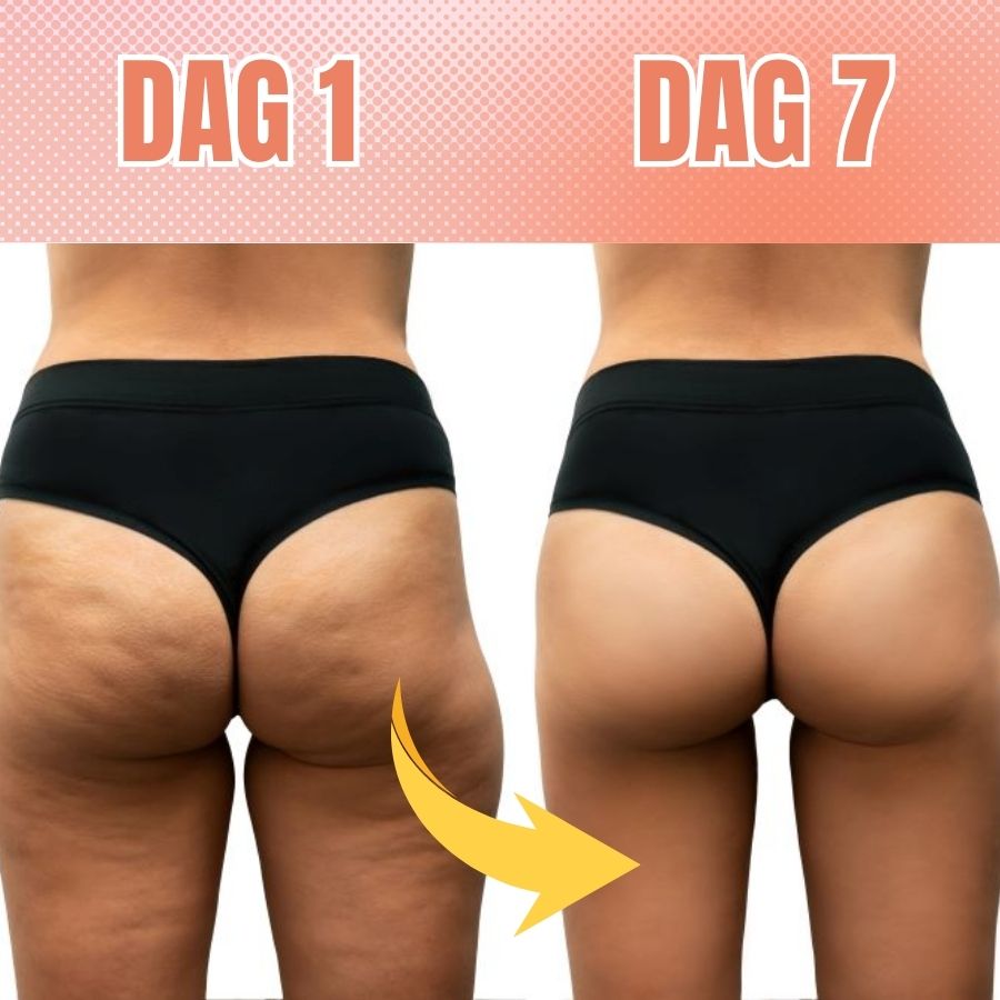 Cellulu™ | Anti-cellulit-leggings