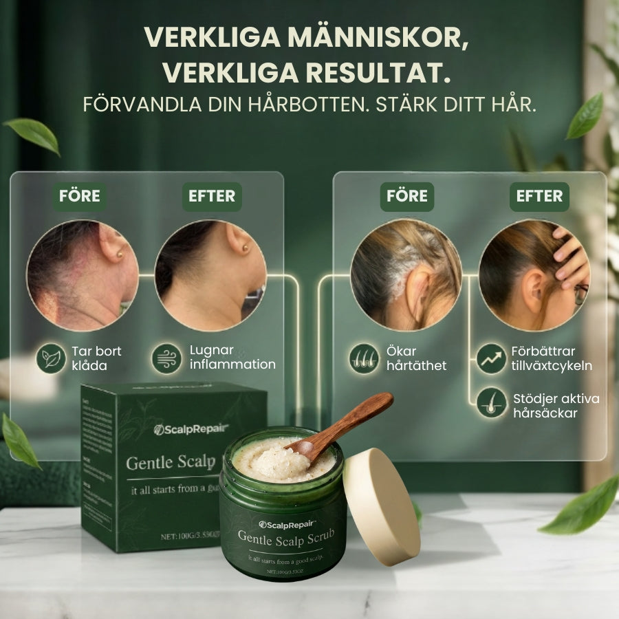 ScalpRepair™ | Skonsam hårbottenpeeling