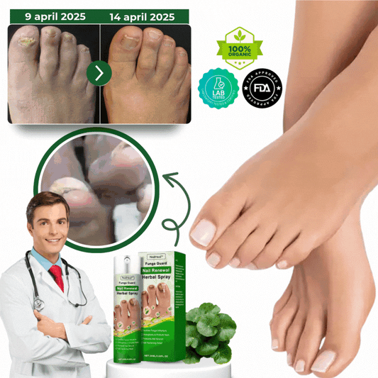 NailHeal™ | Ört-Nagel-Förnyelse-Spray