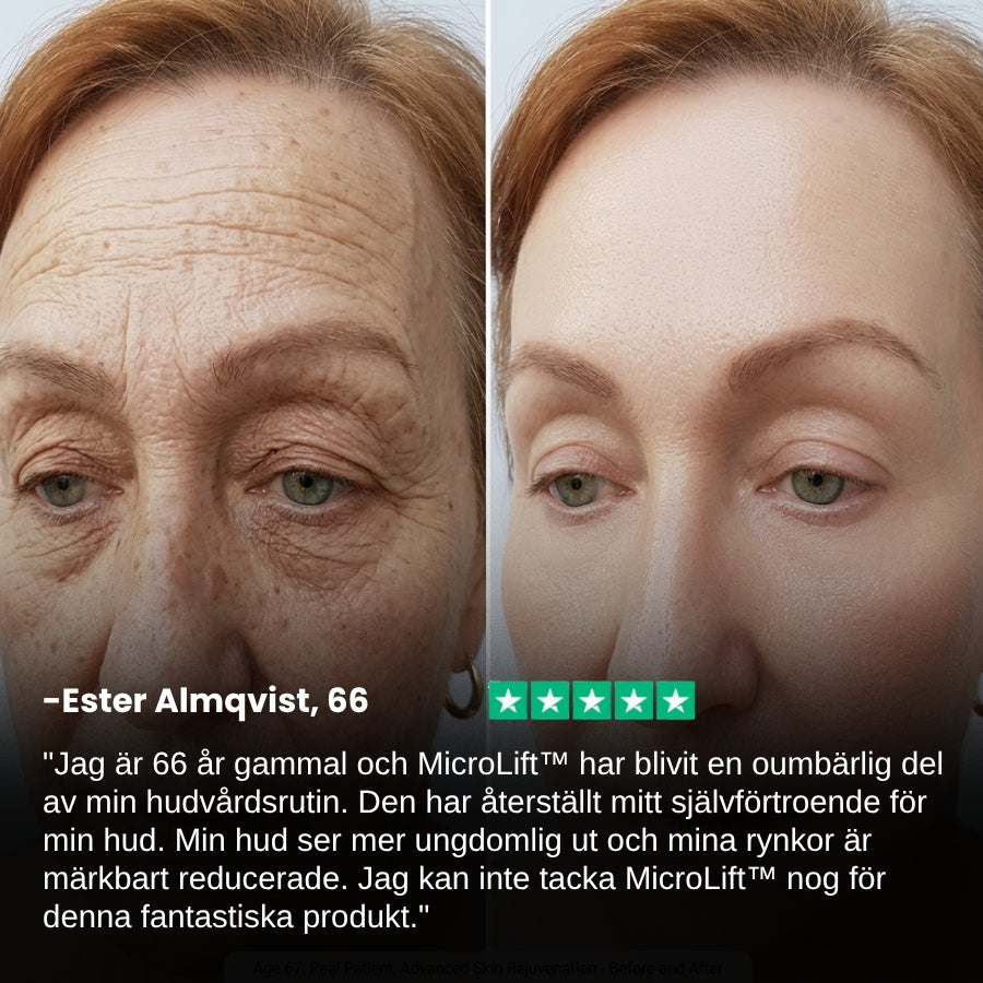 MicroLift™ | Anti-aging-plåster