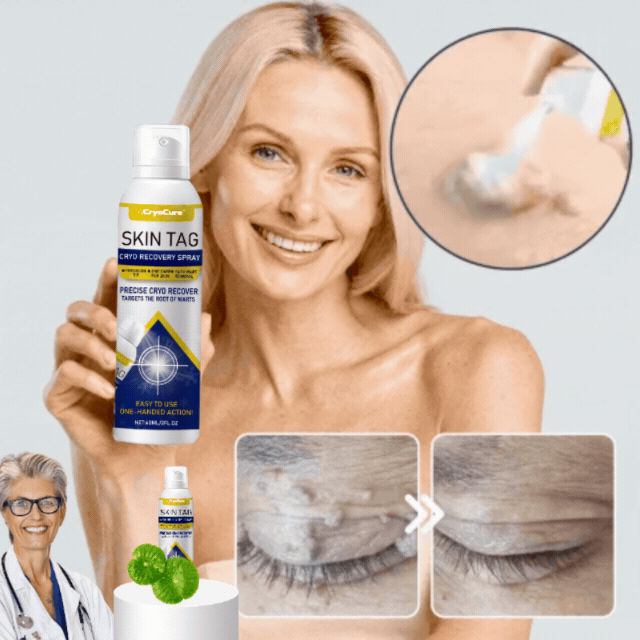 CryoCure™ Spray | Eliminerar envisa vårtor och mjukgör huden på 7 dagar