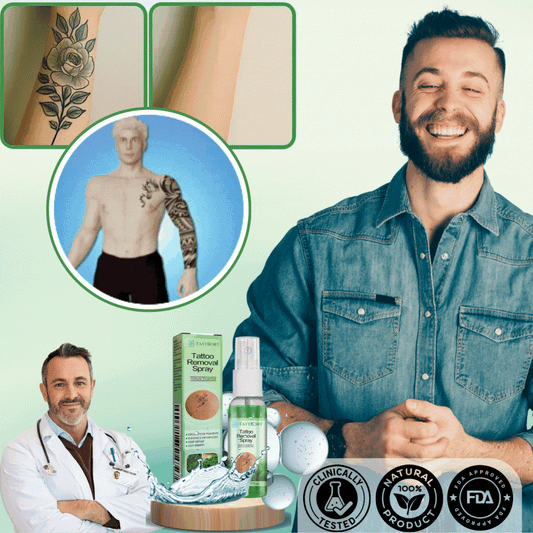 TattBort™ | 99% Tatueringstinte borttagen!