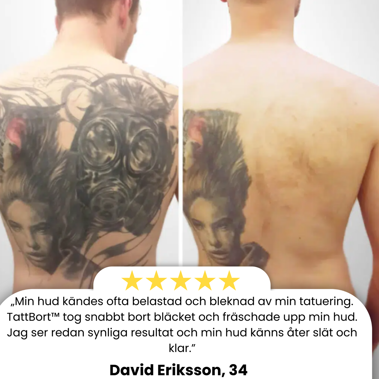 TattBort™ | 99% Tatueringstinte borttagen!