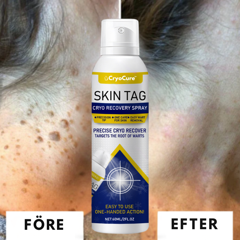 CryoCure™ Spray | Eliminerar envisa vårtor och mjukgör huden på 7 dagar