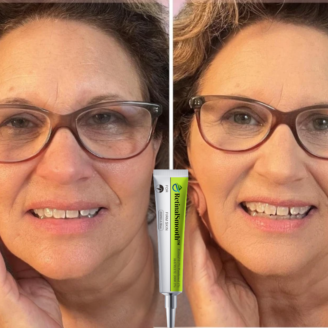 RetinalSmooth™ | Retinalkräm
